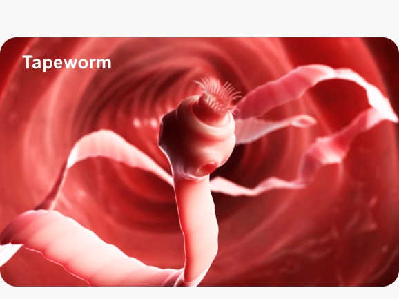 tapeworm image